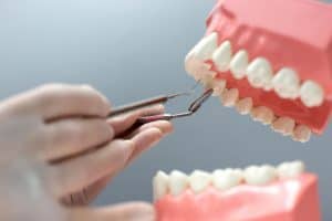 האם כואב להתקין שיניים תותבות